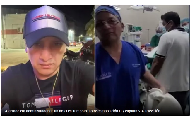Joven se operÃ³ la nariz, pero terminÃ³ con muerte cerebral en Tarapoto