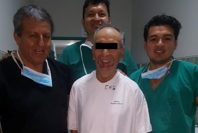 En el Hospital regional Virgen de Fátima de Chachapoyas se realizó una exitosa intervención quirúrgica