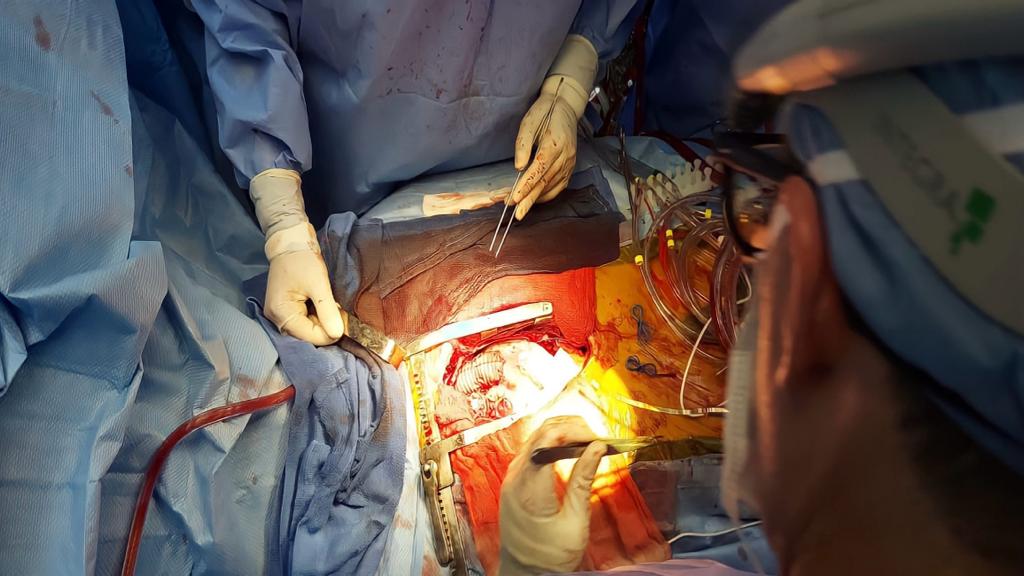 INSN de BreÃ±a destaca por realizar cirugÃ­as complejas que salvan la vida a pacientes pediÃ¡tricos